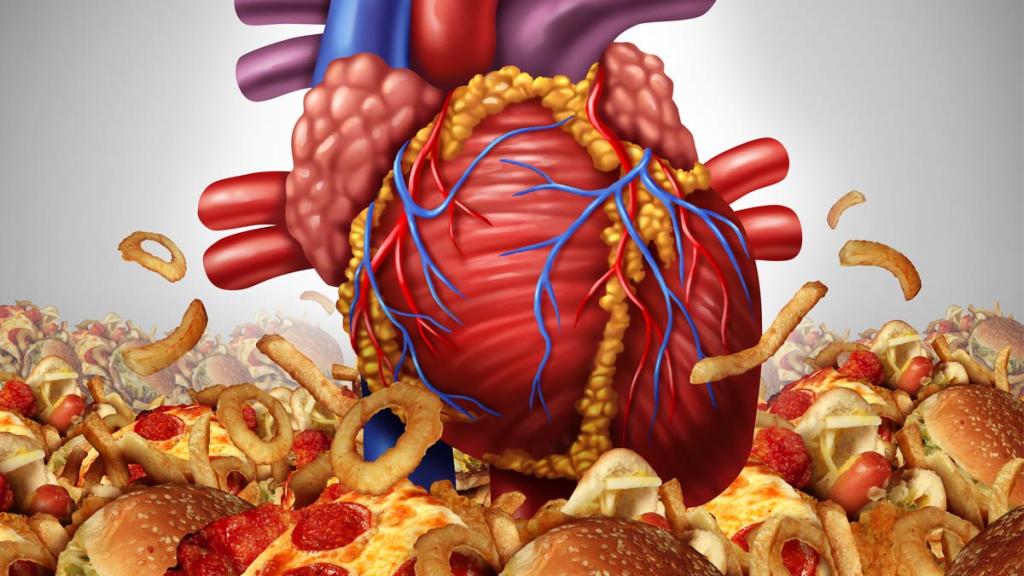 Dietary Fat and Heart disease