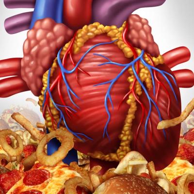 Dietary Fat and Heart disease